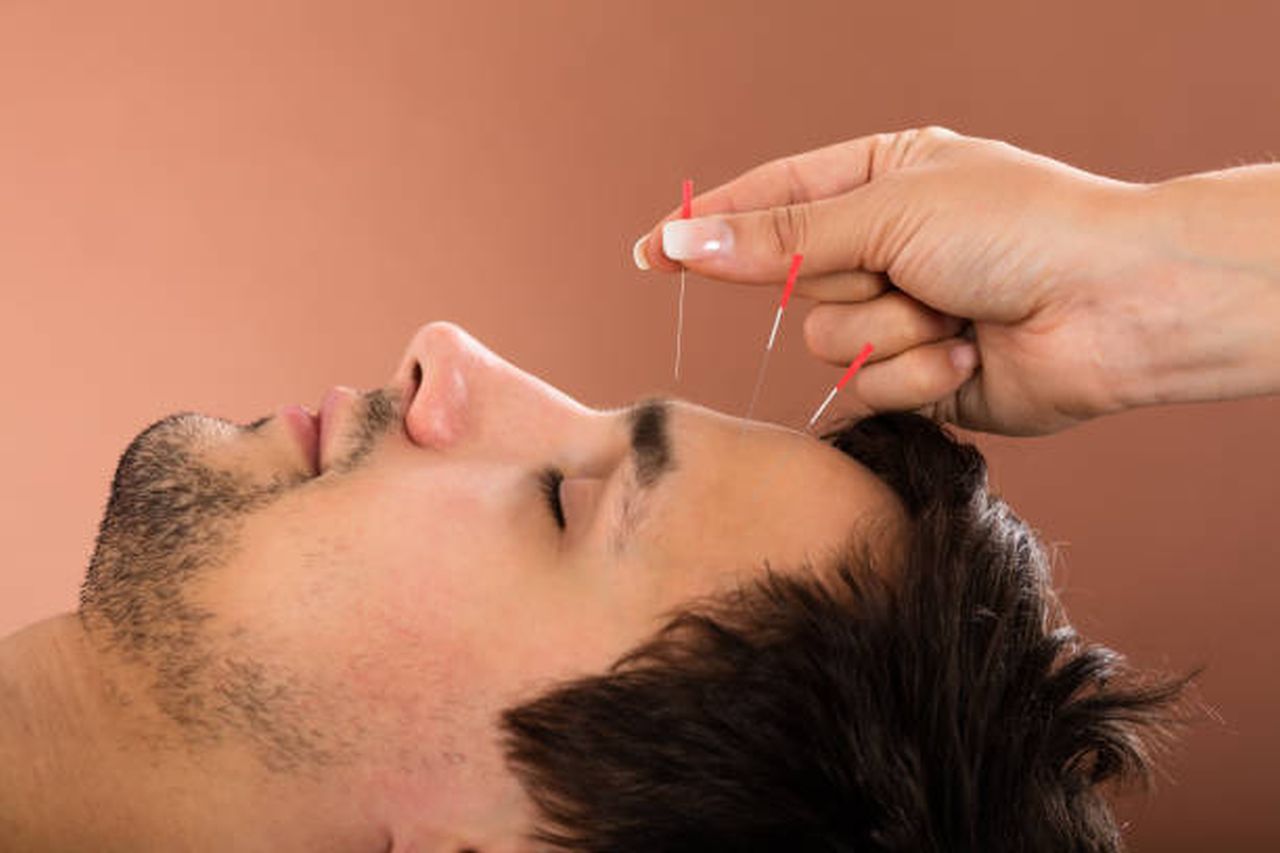 Express Yourself &ndash; Facial Acupuncture