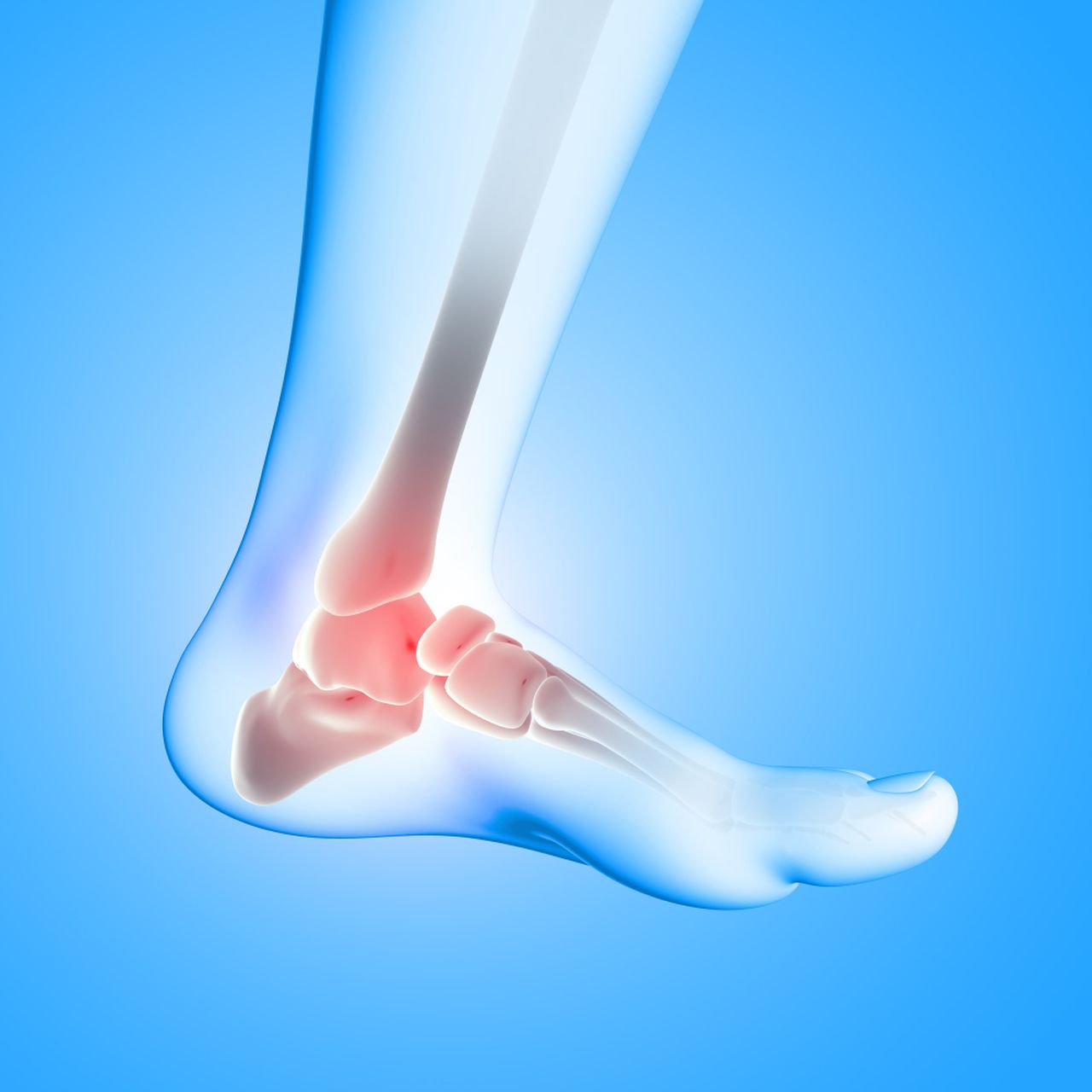 The Hidden Link: How Flat Feet Contribute to Ankle Instability