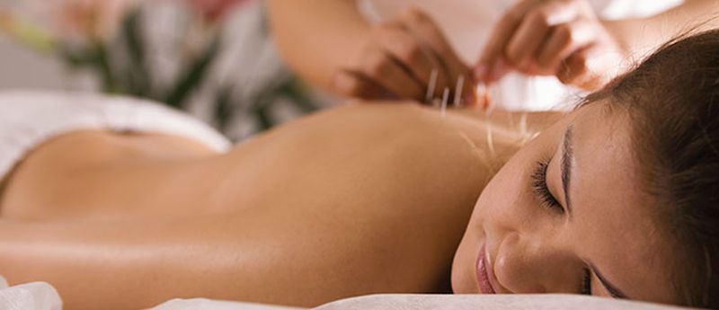 What is Acupuncture?